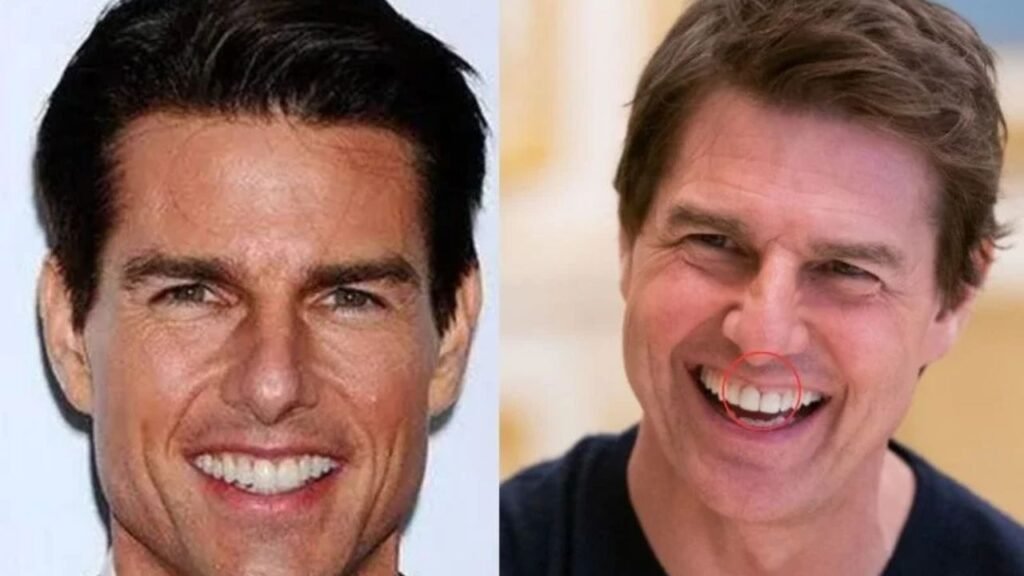 Tom Cruise Teeth 