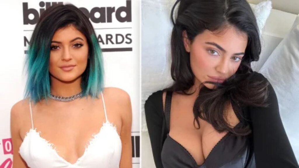 kylie jenner before and after breast transformation