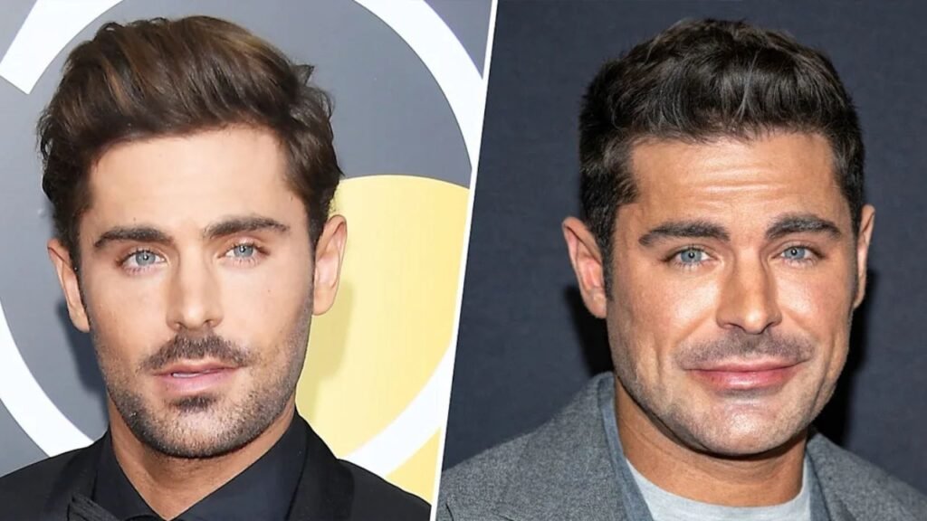 Zac Efron Before and After Plastic Surgery
