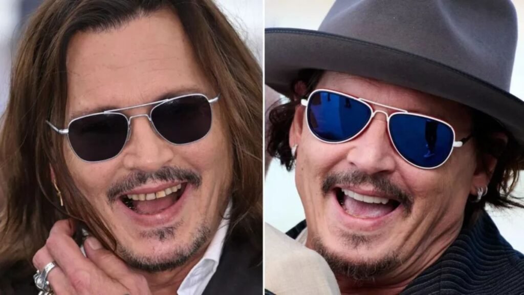 Johnny Depp Teeth Before and After